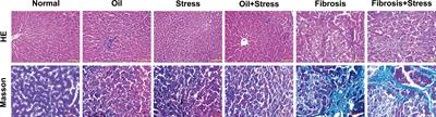 Brain-gut-liver axis: Chronic psychological stress promotes liver injury and fibrosis via gut in rats